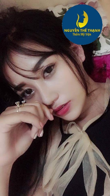 Thương hiệu - Mách bạn địa chỉ nâng mũi đẹp và an toàn (Hình 3).