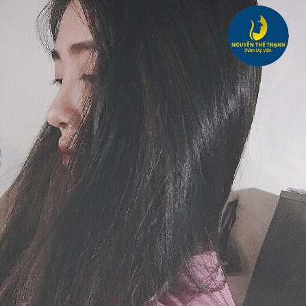 Thương hiệu - Mách bạn địa chỉ nâng mũi đẹp và an toàn (Hình 4).