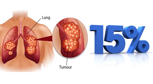 Truyền thông - Giải đáp câu hỏi 'Người bị ung thư phổi có chữa được không?'