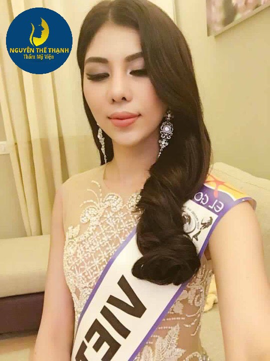 Truyền th&ocirc;ng - Thẩm mỹ viện B&aacute;c sĩ Nguyễn Thế Thạnh khuyến m&atilde;i &ldquo;khủng&rdquo; (H&igrave;nh 2).