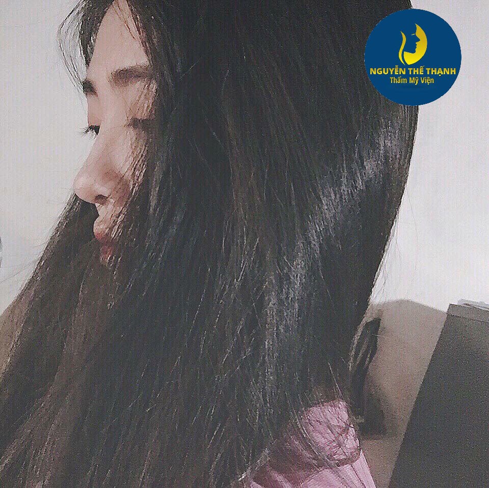 Truyền th&ocirc;ng - Thẩm mỹ viện B&aacute;c sĩ Nguyễn Thế Thạnh khuyến m&atilde;i &ldquo;khủng&rdquo; (H&igrave;nh 5).