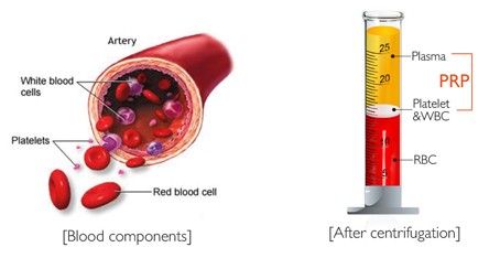 Truyền thông - PRP - Xu hướng mới trong phẫu thuật thẩm mỹ hiện nay