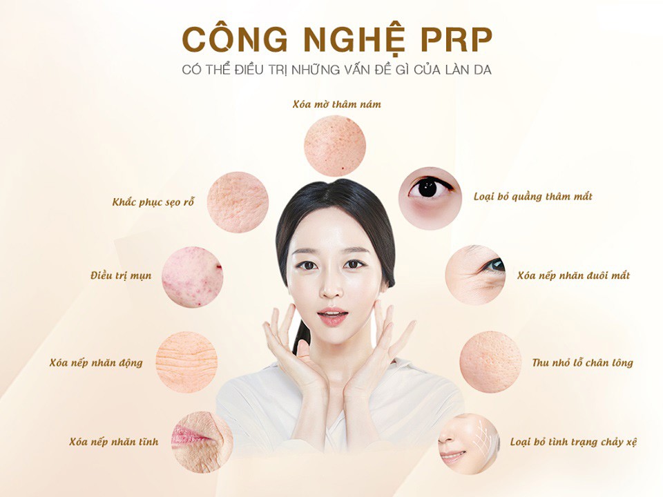 Truyền thông - PRP - Xu hướng mới trong phẫu thuật thẩm mỹ hiện nay (Hình 2).