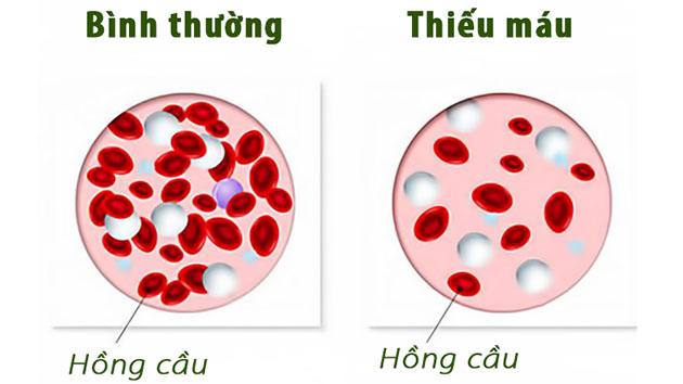 Truyền thông - Nắm vững các tác dụng phụ của hóa chất để có phương pháp can thiệp kịp thời (Hình 2).