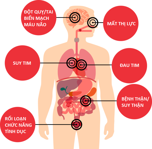 Truyền thông - Huyết áp cao và nguy cơ gây biến chứng suy thận