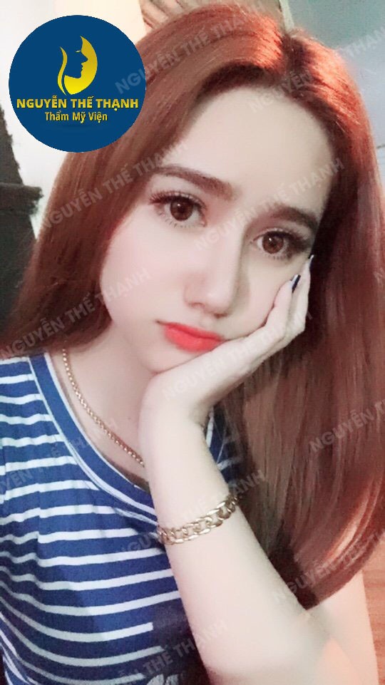 Truyền thông - Bạn hiểu gì về công nghệ cắt mí Hàn Quốc? (Hình 2).