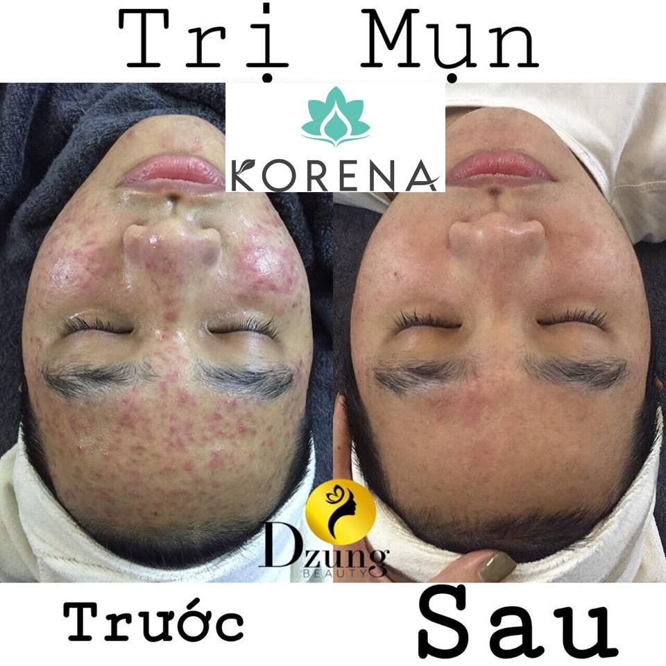 Thương hiệu - Mỹ phẩm Korena bùng nổ kinh doanh với chuỗi các spa trên toàn quốc