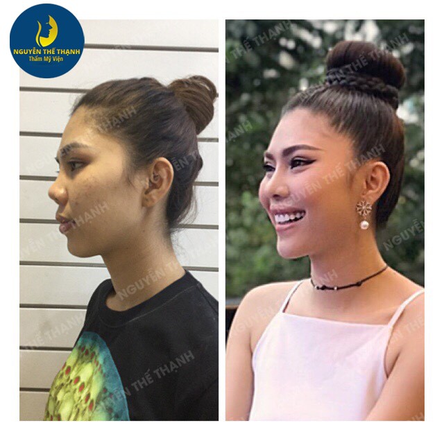 Truyền thông - Gương mặt tỏa sáng hơn với ưu đãi 30% nhân dịp 8/3 tại TMV Bác sĩ Nguyễn Thế Thạnh (Hình 2).