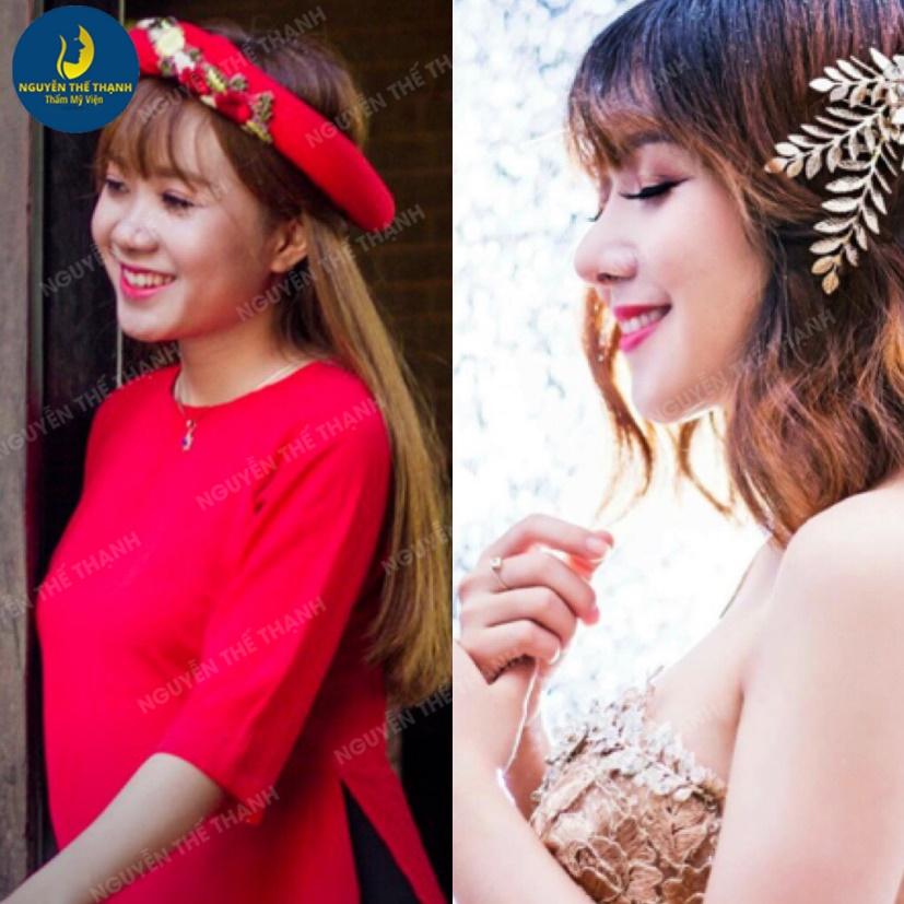 Truyền thông - Gương mặt tỏa sáng hơn với ưu đãi 30% nhân dịp 8/3 tại TMV Bác sĩ Nguyễn Thế Thạnh (Hình 3).