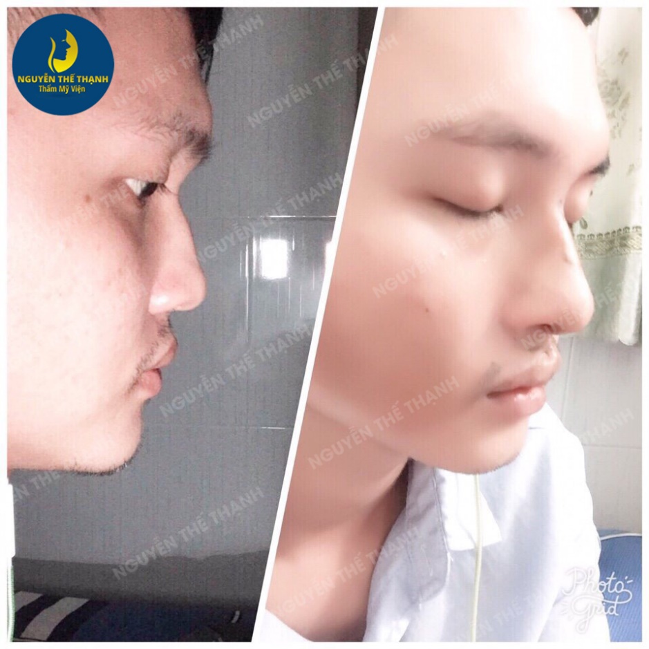 Truyền thông - Gương mặt tỏa sáng hơn với ưu đãi 30% nhân dịp 8/3 tại TMV Bác sĩ Nguyễn Thế Thạnh (Hình 4).