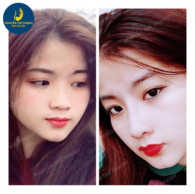 Truyền thông - Gương mặt tỏa sáng hơn với ưu đãi 30% nhân dịp 8/3 tại TMV Bác sĩ Nguyễn Thế Thạnh (Hình 5).