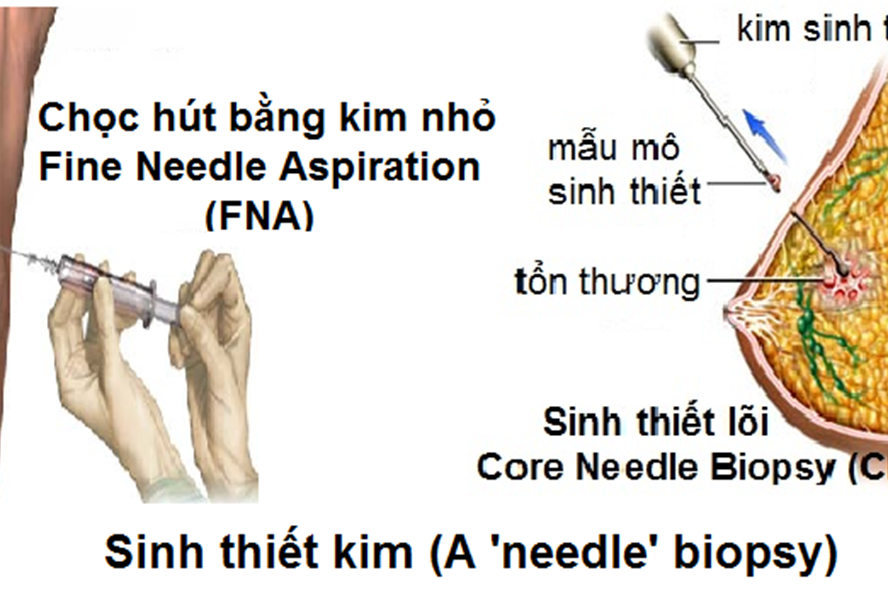 Truyền thông - Hãy gặp bác sỹ làm các xét nghiệm ung thư sau để phát hiện bệnh sớm (Hình 2).