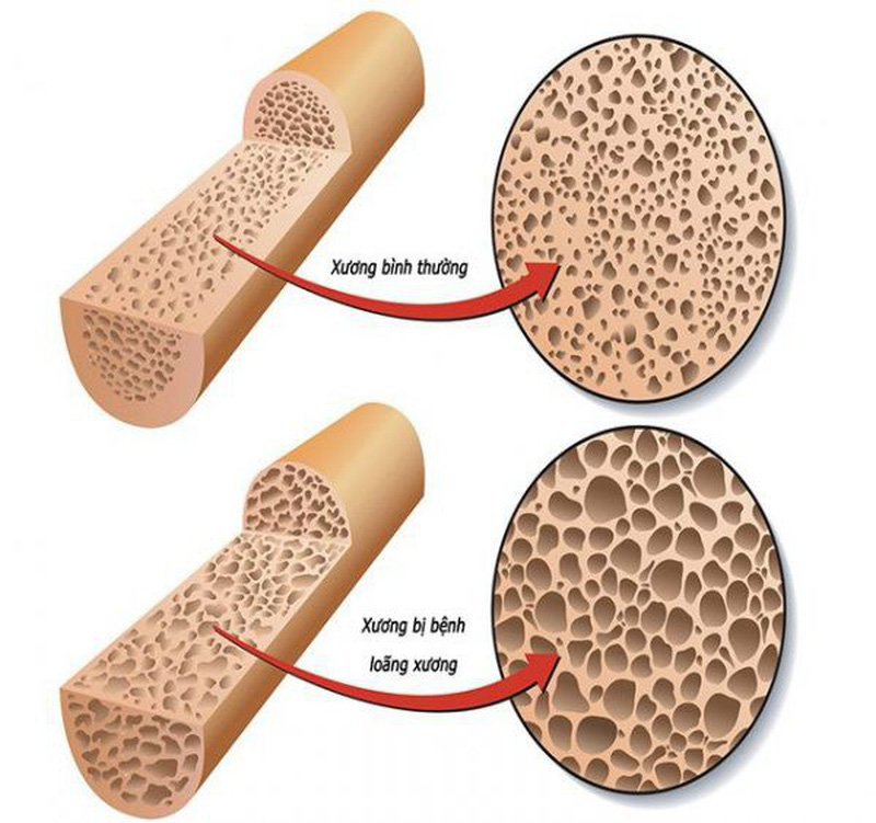 Thương hiệu - Top 3 máy lọc nước tạo ion canxi bán chạy số 1 hiện nay (Hình 2).