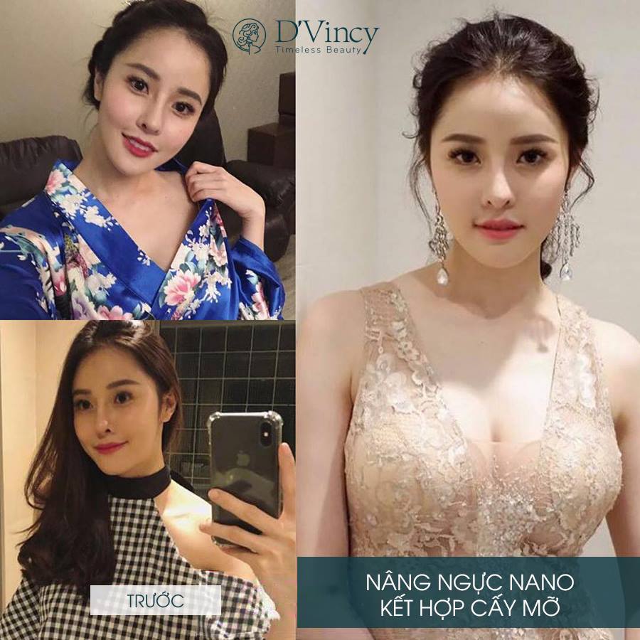 Truyền thông - Điểm tên những dịch vụ thẩm mỹ hút khách đầu hè 2019 (Hình 2).