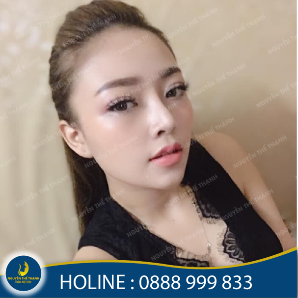 Thương hiệu - Địa chỉ nâng mũi S-Line đẹp, uy tín (Hình 3).