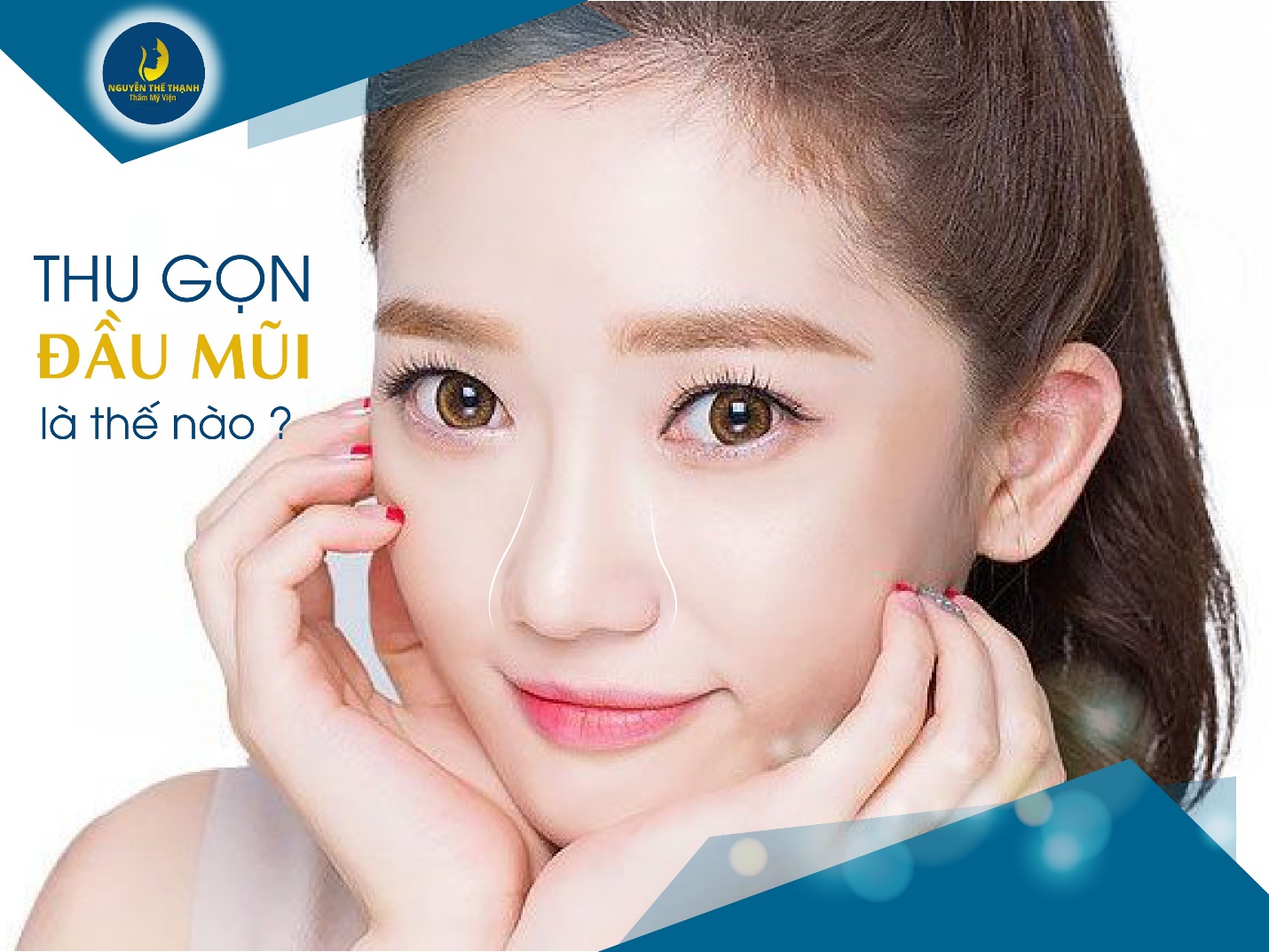 Truyền thông - Thế nào là thu gọn đầu mũi?