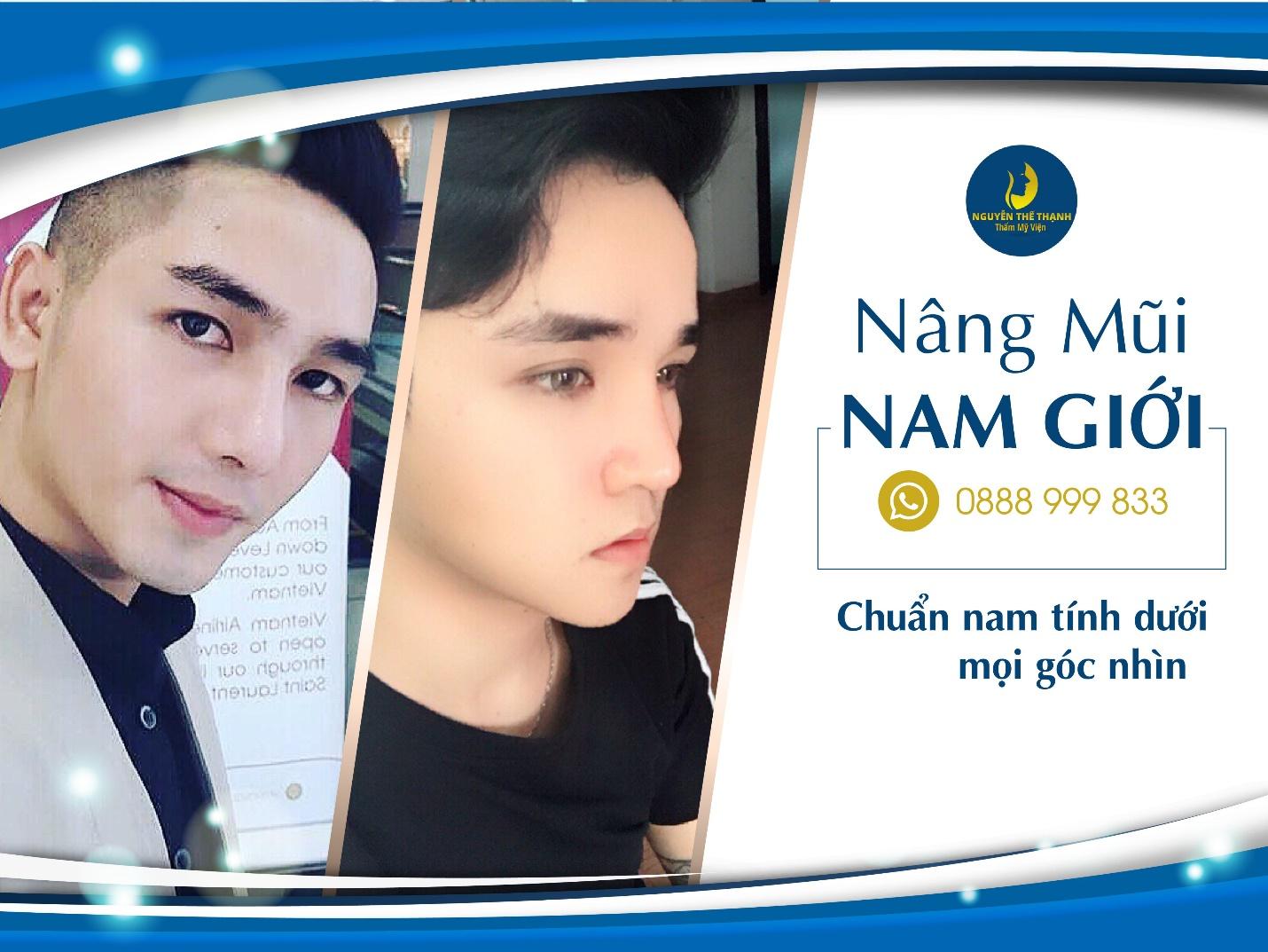 Cần biết - Nâng mũi nam giới: Chuẩn nam tính dưới mọi góc nhìn