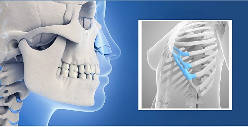 Cần biết - Nâng mũi sụn tự thân: Thực hư về phương pháp giúp tăng tuổi thọ của dáng mũi (Hình 3).