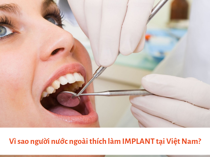 Cần biết - Giải mã lý do tại sao người nước ngoài thích làm răng Implant tại Việt Nam