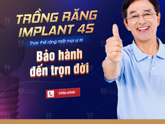 Cần biết - Giải mã lý do tại sao người nước ngoài thích làm răng Implant tại Việt Nam (Hình 2).