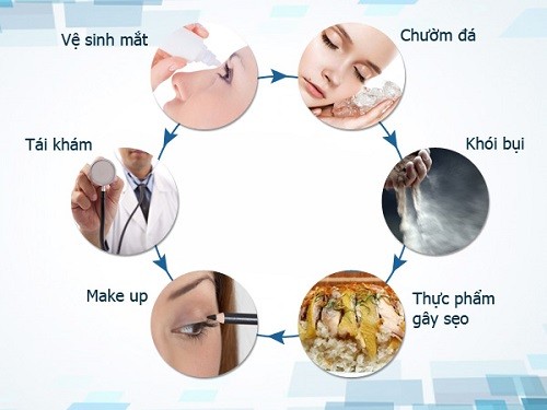 Cần biết - 5 nguyên tắc 'vàng' cắt mắt 2 mí nhất định bạn phải biết  (Hình 3).