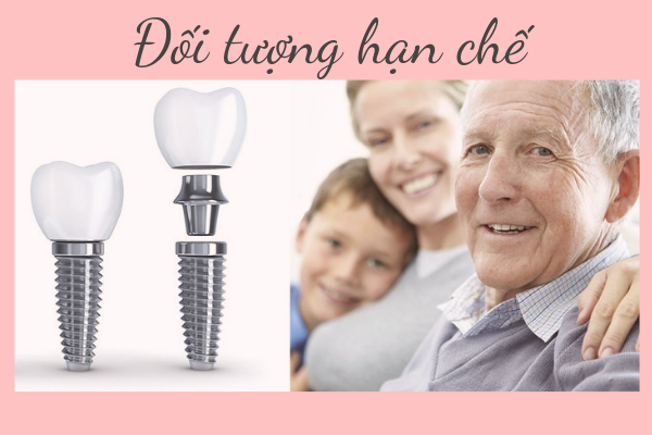 Cần biết - 5 nhược điểm khi làm Implant khiến bạn lo lắng nhất (Hình 3).