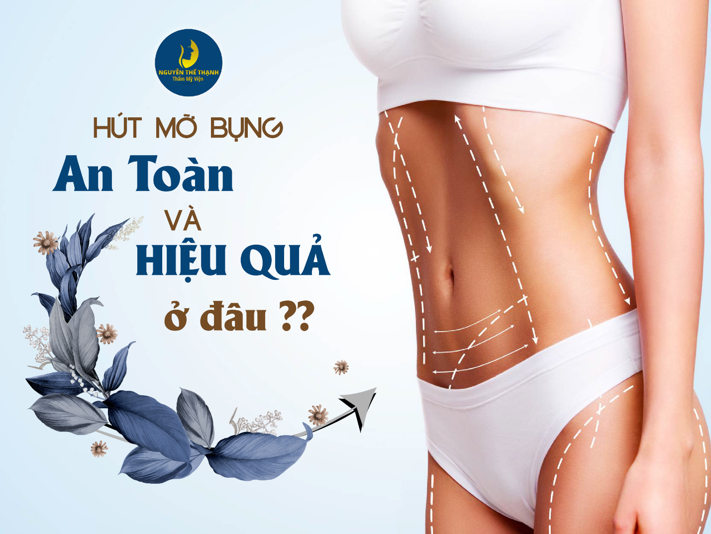 Cần biết - Địa chỉ hút mỡ bụng hiệu quả và an toàn?