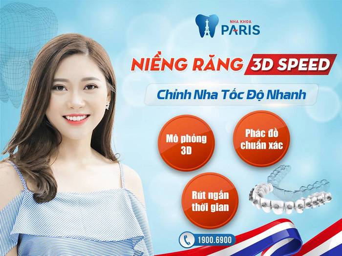 Cần biết - 10 ghi nhớ quan trọng cần thuộc lòng trước khi bắt đầu niềng răng (Hình 5).