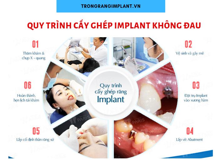 Cần biết - Trồng răng Implant “rất đau” có phải là lầm tưởng? (Hình 2).