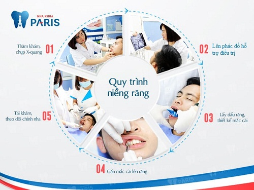 Cần biết - Niềng răng năm 30 tuổi, tại sao không? (Hình 3).