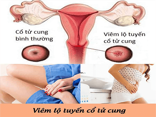 Cần biết - Tổng hợp các bệnh phụ khoa phổ biến và cách điều trị hiệu quả (Hình 2).