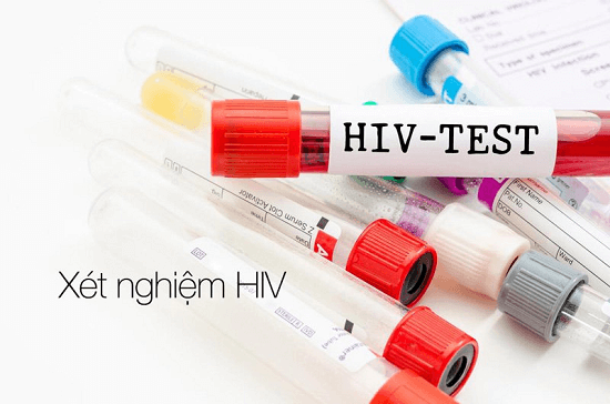 Cần biết - Địa chỉ xét nghiệm HIV ở Hà Nội