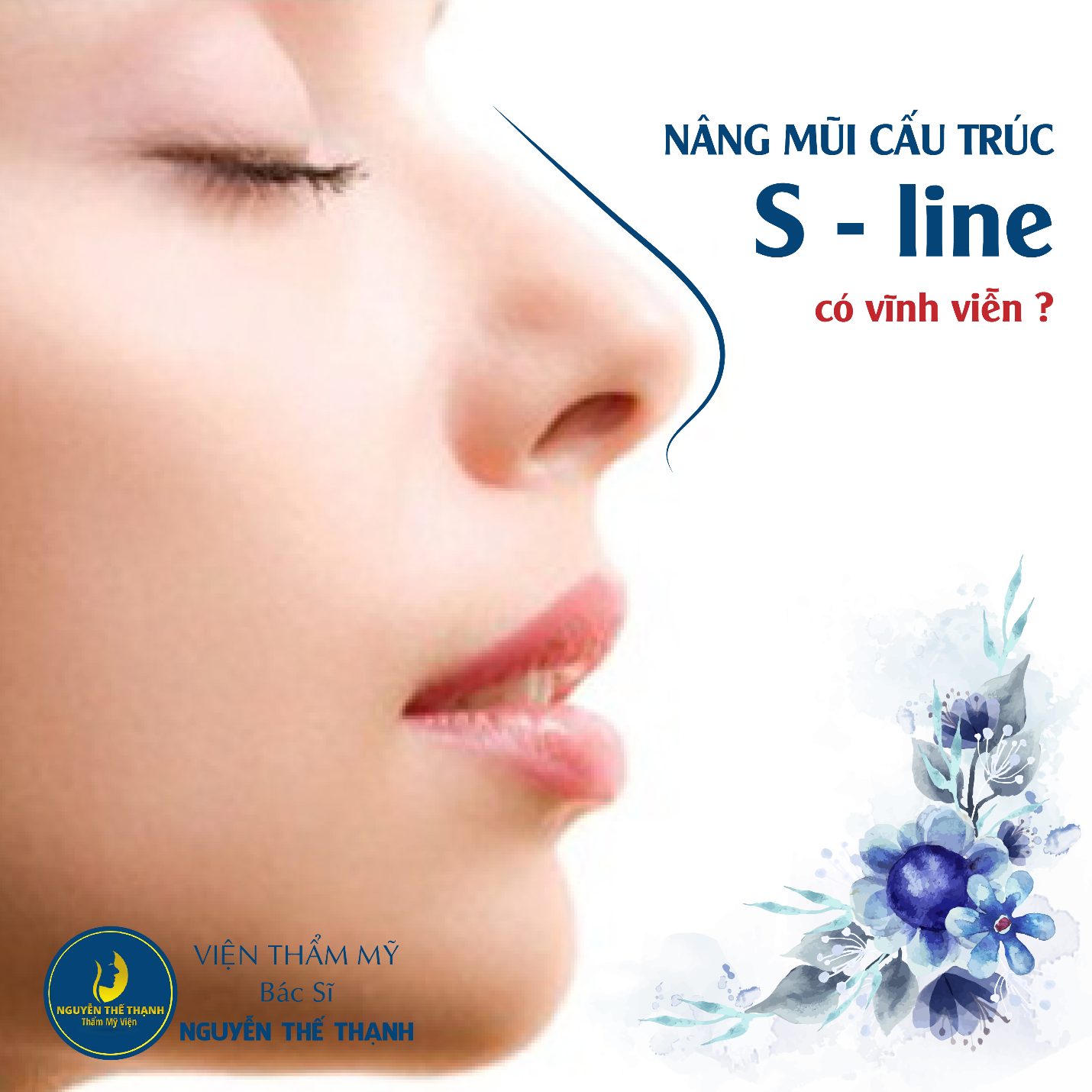 Cần biết - Nâng mũi cấu trúc Sline có vĩnh viễn không?