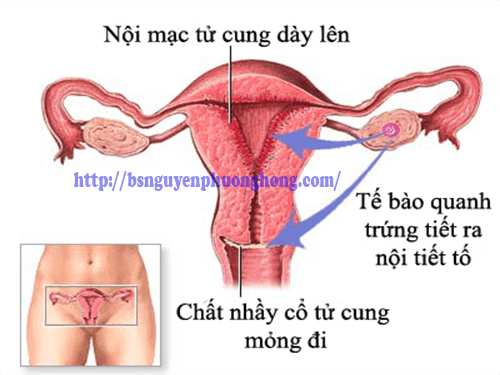 Cần biết - Viêm nội mạc tử cung sau sinh: Triệu chứng, nguyên nhân, cách chữa