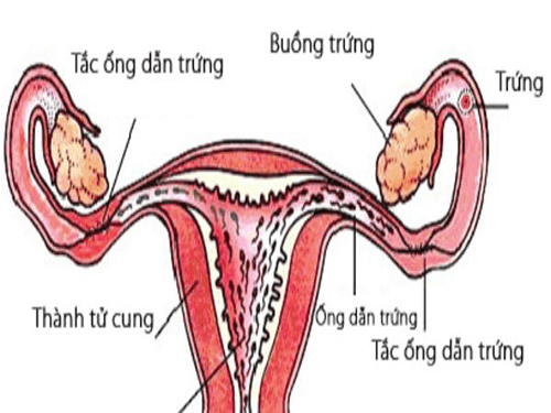 Cần biết - Phá thai nhiều lần có sao không? Đọc ngay nếu không muốn bị vô sinh (Hình 2).