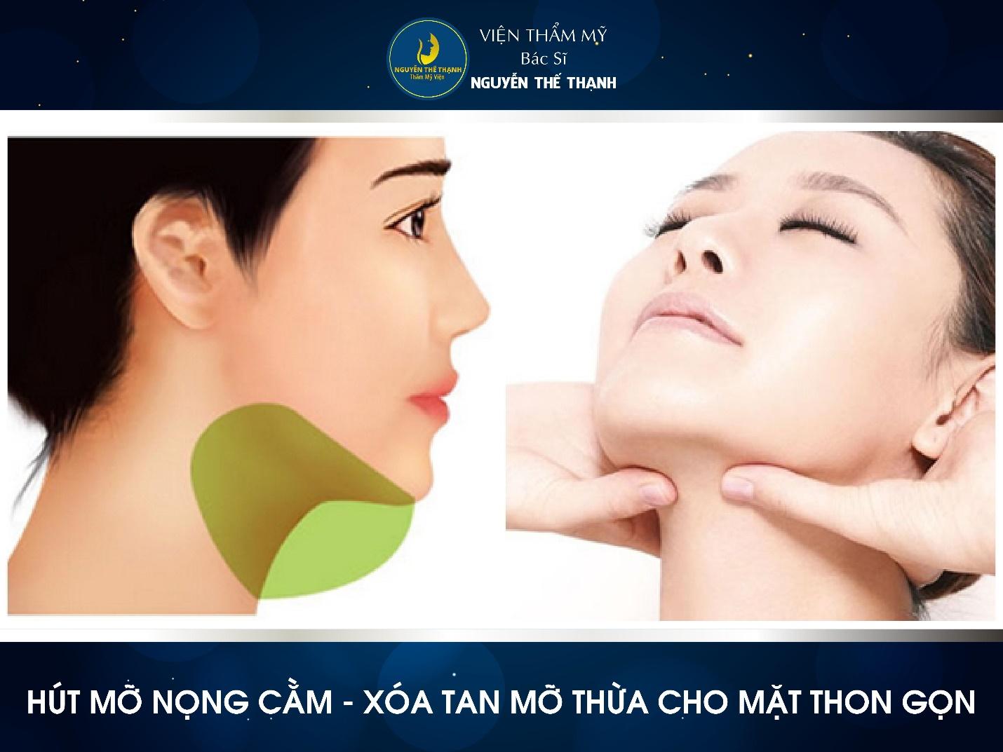 Cần biết - Hút mỡ nọng cằm - Xóa tan mỡ thừa cho mặt thon gọn