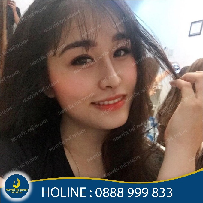 Thương hiệu - Mũi đẹp không lo biến chứng với nâng mũi S-Line bán cấu trúc (Hình 3).