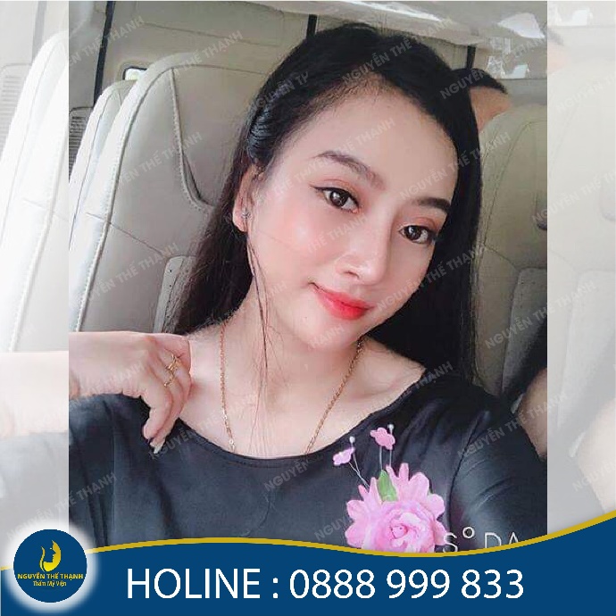 Thương hiệu - Mũi đẹp không lo biến chứng với nâng mũi S-Line bán cấu trúc (Hình 4).