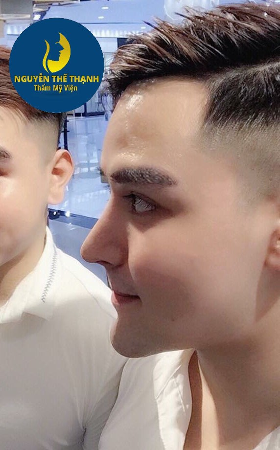 Thương hiệu - Nâng mũi dành cho nam giới – Tôn lên nét đẹp nam tính (Hình 2).