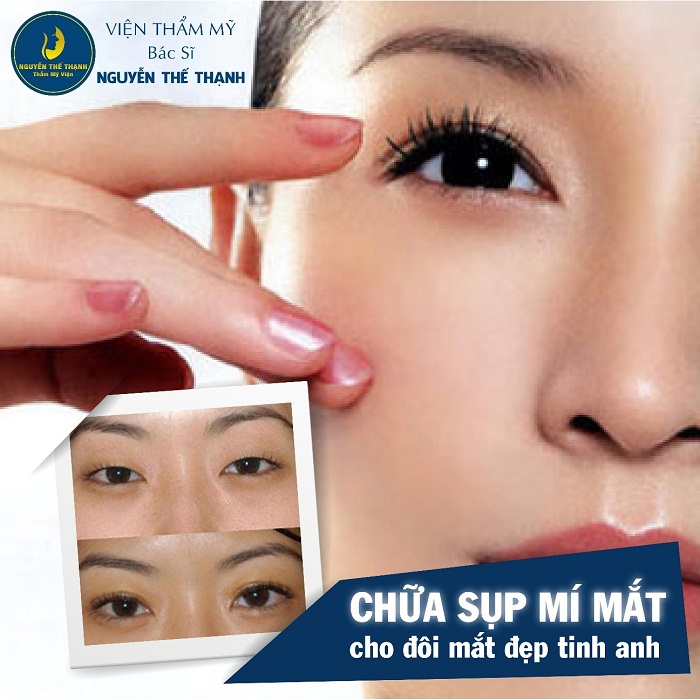 Thương hiệu - Chữa sụp mí mắt – Cho đôi mắt đẹp tinh anh