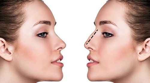 Truyền thông - Có nên phẫu thuật thẩm mỹ không và lời giải trấn an dư luận