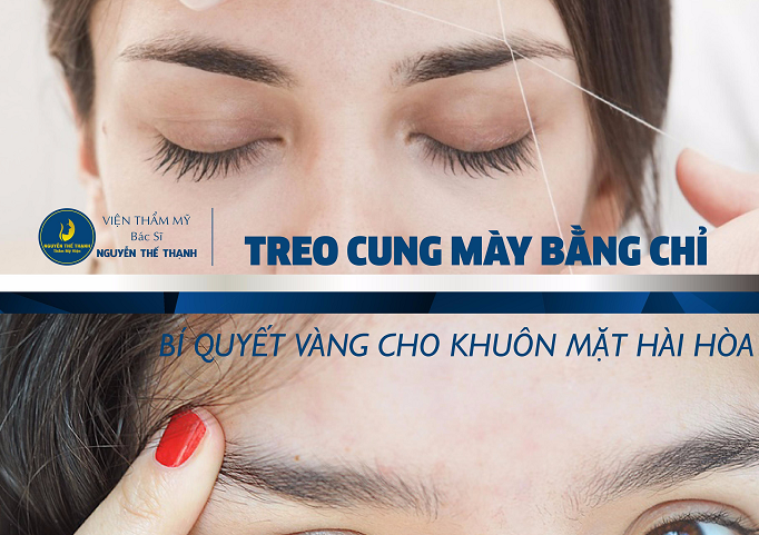 Truyền thông - Treo cung mày bằng chỉ – Bí quyết vàng cho khuôn mặt hài hoà