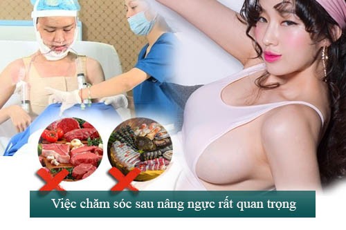 Thương hiệu - Nâng ngực chảy xệ nội soi, giải pháp gọn nhẹ cho Eva bận rộn (Hình 3).