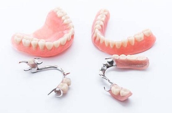 Cần biết - Trồng răng implant giúp cha mẹ cười đẹp ăn ngon vui đón Tết  (Hình 2).