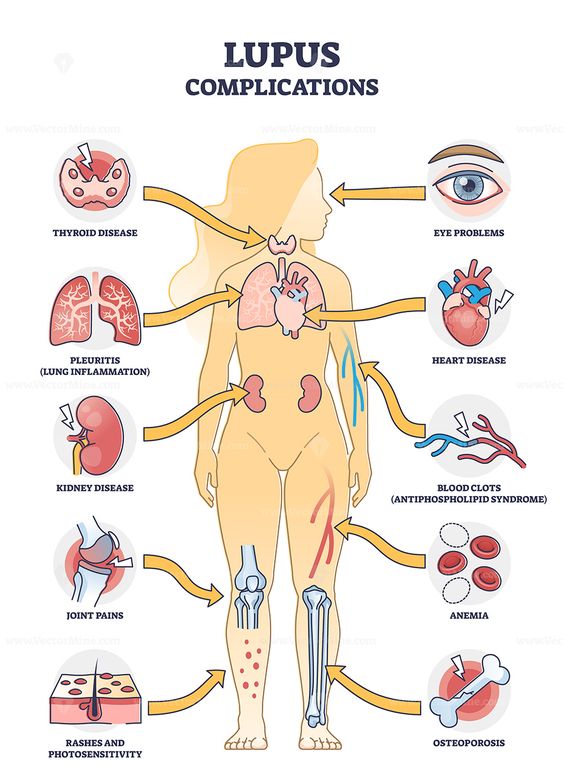 Sức khỏe - Sau khi ăn tiệc thì cấp cứu do nôn ói, phát hiện bệnh cực kỳ nguy hiểm (Hình 3).