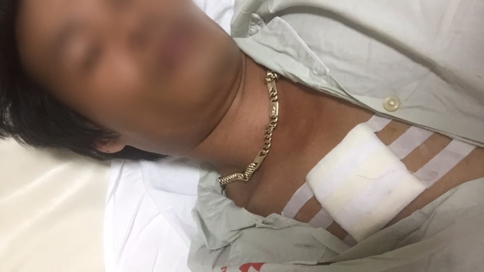 An ninh - Hình sự - Vụ côn đồ cầm dao xông vào nhà chém người dân: Đến bệnh viện để truy sát