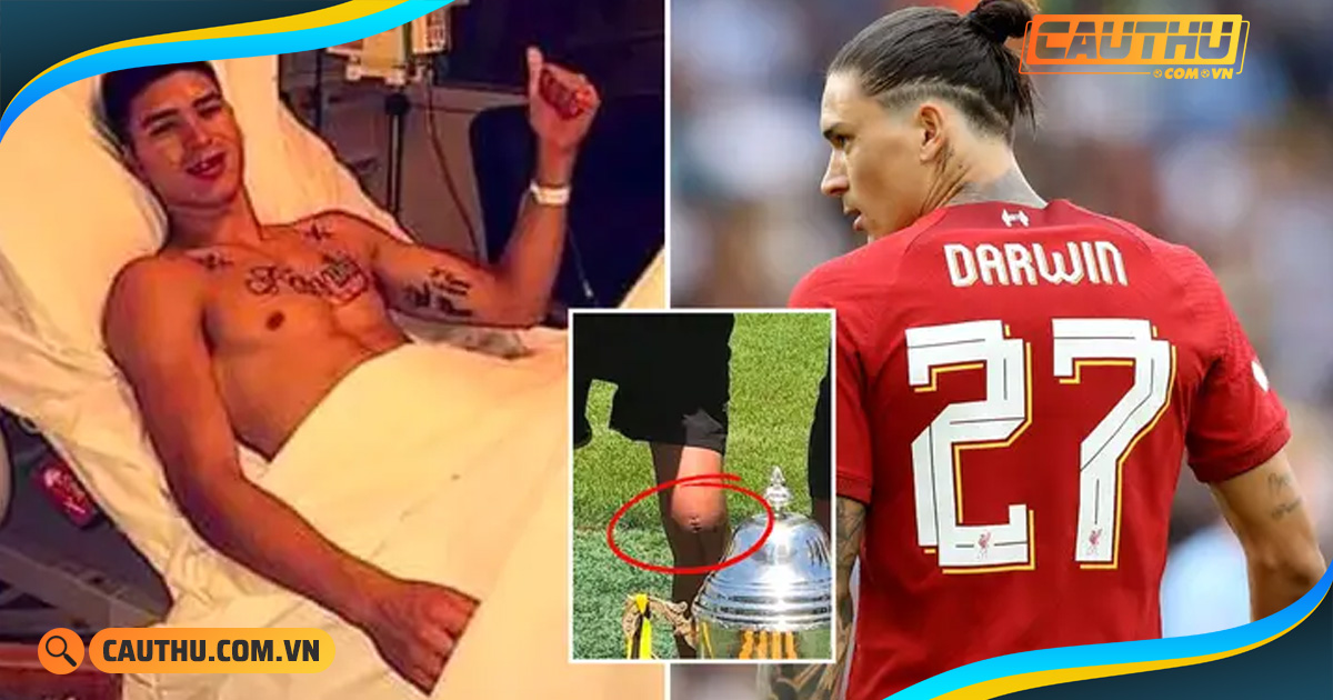 Bóng đá Anh - Nunez từng chấn thương suýt mất nghiệp, Liverpool có lo?