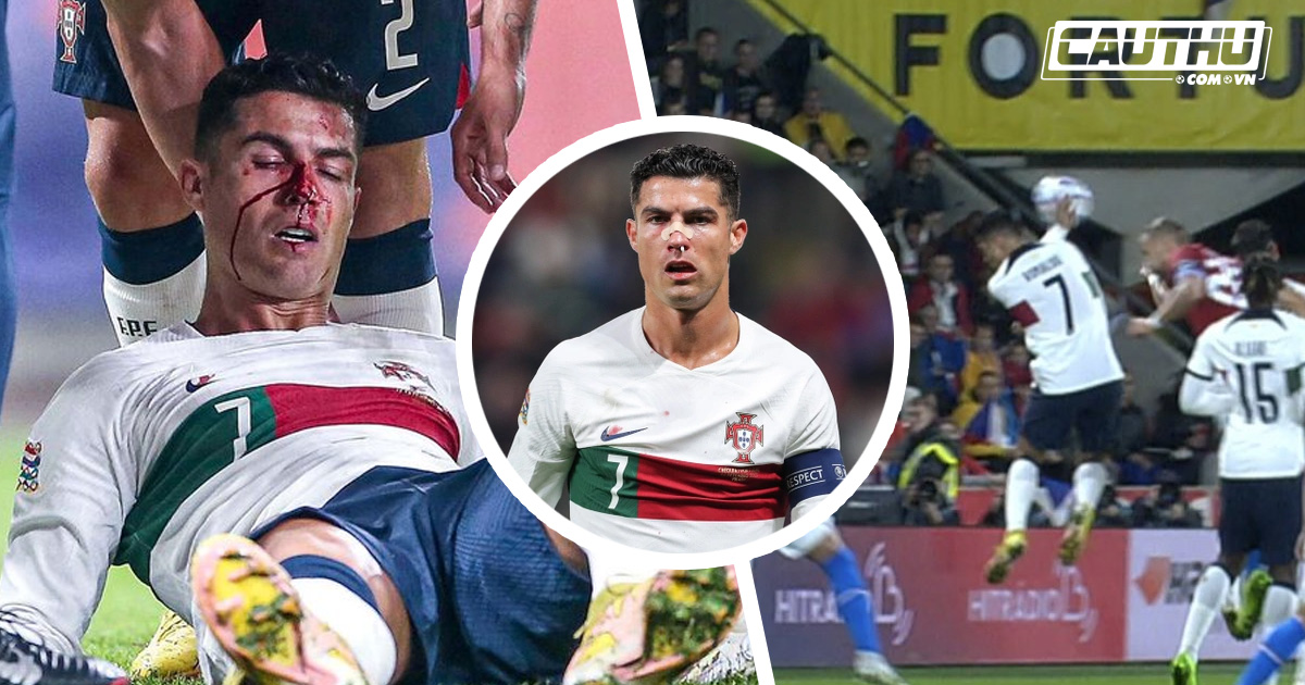 Giải khác - Ngày siêu đen của Ronaldo: tịt ngòi, đổ máu và suýt thành tội đồ