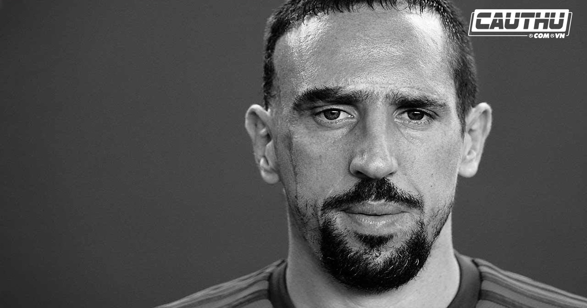 Giải khác - Câu chuyện đau lòng đằng sau những vết sẹo trên mặt của Ribery