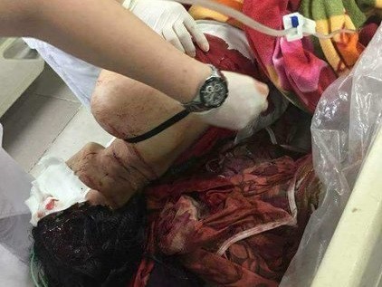Phú Thọ: Điều tra vụ chồng dùng dao chém vợ trọng thương